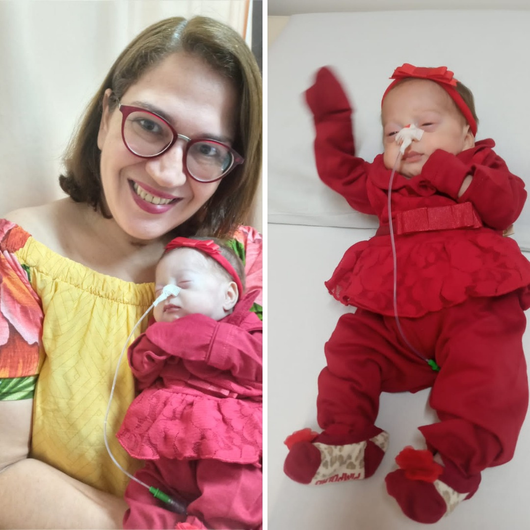 Duas fotos, na primeira mulher segura bebê e sorri; na segunda, bebê dorme vestida de vermelho