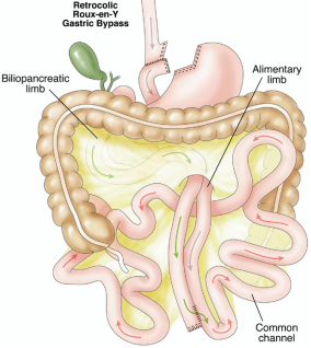 Imagem de um intestino